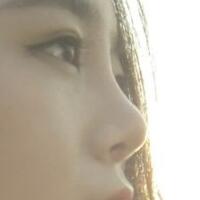 隆鼻整形價(jià)格和真實(shí)恢復(fù)期圖片——杭州悅可整容醫(yī)院