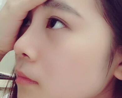 隆鼻整形價格和真實恢復(fù)期圖片