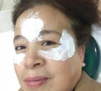 去抬頭紋方法？杭州悅可整容推薦注射瘦臉去抬頭紋魚尾紋