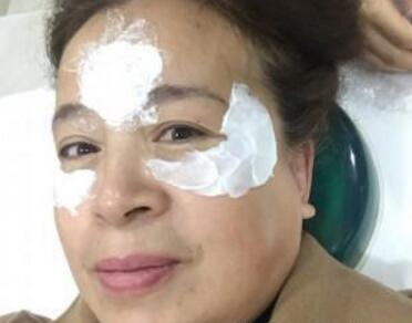 去抬頭紋很好的方法？注射瘦臉去抬頭紋魚尾紋