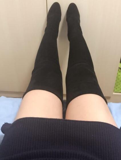 吸脂減肥瘦大腿前后對(duì)比圖，光纖溶脂瘦大腿較有的方法真實(shí)案例