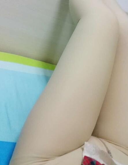 吸脂減肥瘦大腿前后對(duì)比圖，光纖溶脂瘦大腿較有的方法真實(shí)案例