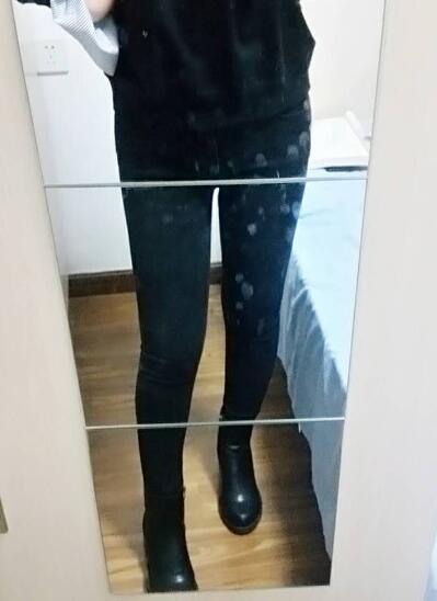 吸脂減肥瘦大腿前后對(duì)比圖，光纖溶脂瘦大腿較有的方法真實(shí)案例