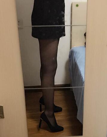 吸脂減肥瘦大腿前后對(duì)比圖，光纖溶脂瘦大腿較有的方法真實(shí)案例