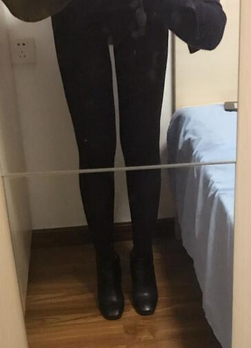 吸脂減肥瘦大腿前后對(duì)比圖，光纖溶脂瘦大腿較有的方法真實(shí)案例