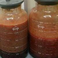 水動力吸脂瘦大腿真實案例多對比圖經(jīng)歷——西安瑞麗整形