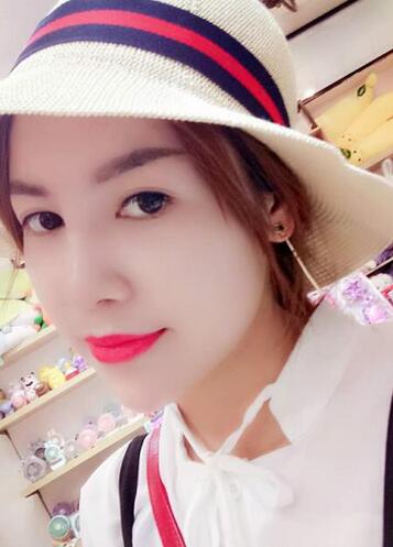 隆鼻整形一個月恢復期圖片 武漢壹加壹隆鼻整形案例