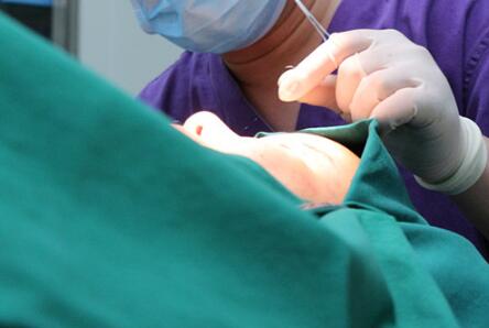 割雙眼皮手術(shù)價(jià)格 雙眼皮對比圖恢復(fù)過程