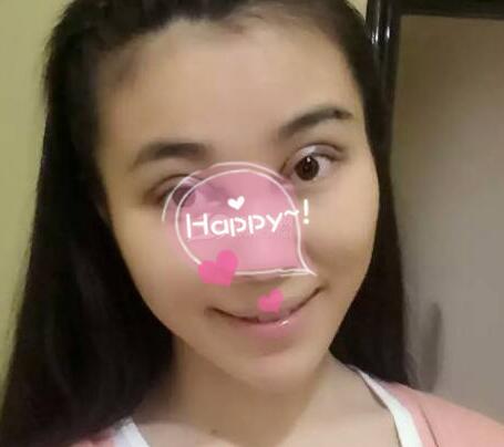 割雙眼皮手術(shù)價(jià)格 雙眼皮對比圖恢復(fù)過程