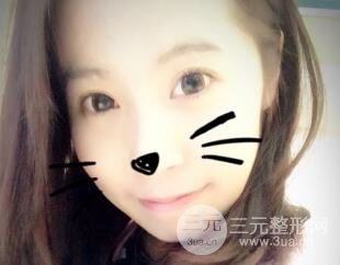 真人內(nèi)切去眼袋手術(shù)過程對比圖片和案例分享