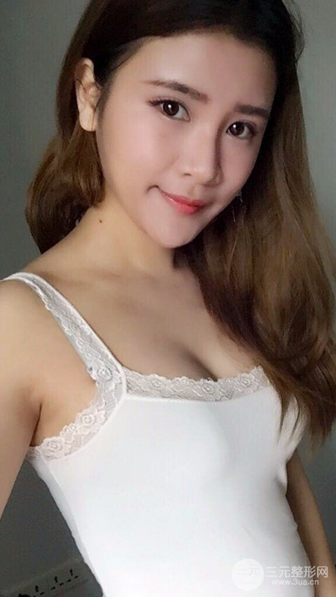 淄博陽(yáng)光整形自體脂肪隆胸前后對(duì)比圖，真實(shí)案例