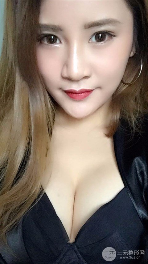 淄博陽(yáng)光整形自體脂肪隆胸前后對(duì)比圖，真實(shí)案例