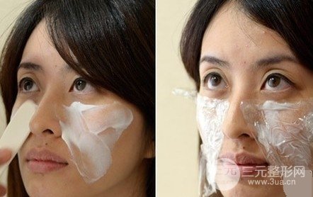 “人未老，皺先行”，注射除皺面部年輕化修復(fù)過程