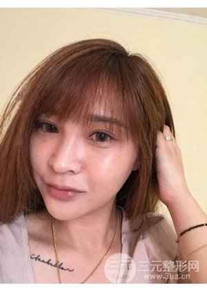 高強度聚焦超聲手術前后過程以及真實案例分享——廈門思明安黛美林韻醫(yī)生做的