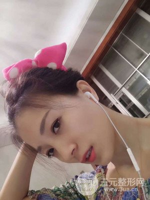 分享我的激光祛眼袋手術前后過程，廈門思明安黛美林韻醫(yī)生做的