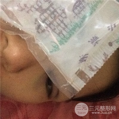 濟(jì)南曹博士美容醫(yī)院曹景敏眼部綜合整形真人案例分享