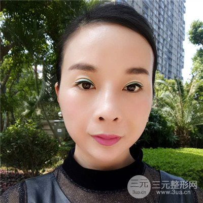 濟(jì)南曹博士美容醫(yī)院曹景敏埋埋蛋白線.提升真人案例分享