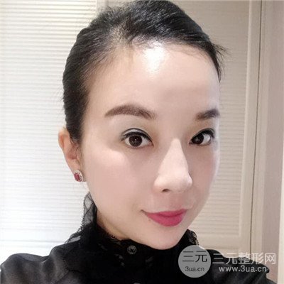 濟(jì)南曹博士美容醫(yī)院曹景敏埋埋蛋白線.提升真人案例分享