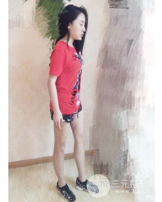 大腿吸脂前后對(duì)比照片，南昌永康王忠干真實(shí)案例分享