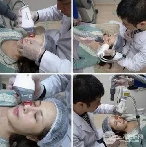 我做了光子嫩膚幾天起而且價(jià)格便宜前后對比照片案例