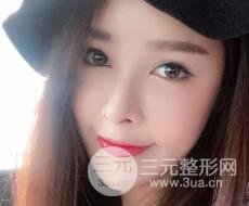 大腿抽脂做臉部脂肪填充 包括太陽穴和額頭價(jià)格果分享