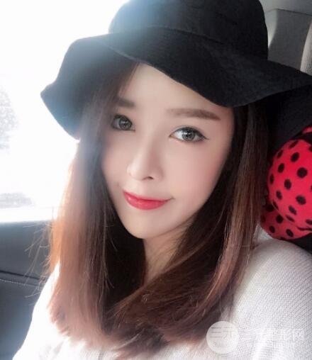 大腿抽脂做臉部脂肪填充 包括太陽穴和額頭價格果分享