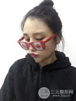 珠海萊茵門診部馬中衛(wèi)隆鼻整形案例分享，并附上前后對(duì)比照片~