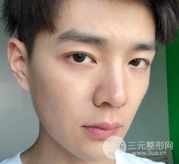 高強(qiáng)度聚焦超聲面b提升術(shù)多少錢?親身經(jīng)歷案例