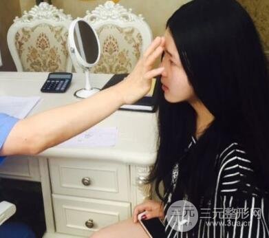 隆鼻整形包括假體隆鼻+耳軟骨墊鼻尖+鼻小柱延長