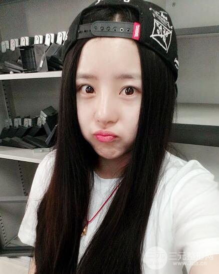 隆鼻整形包括假體隆鼻+耳軟骨墊鼻尖+鼻小柱延長