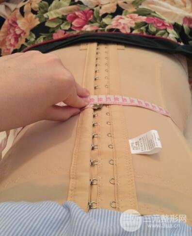 腹部抽脂價(jià)格和恢復(fù)案例