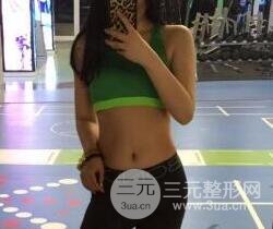 腹部抽脂價(jià)格和恢復(fù)案例