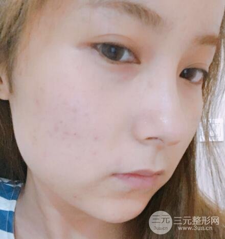 注射水光補(bǔ)水價(jià)格和案例圖片