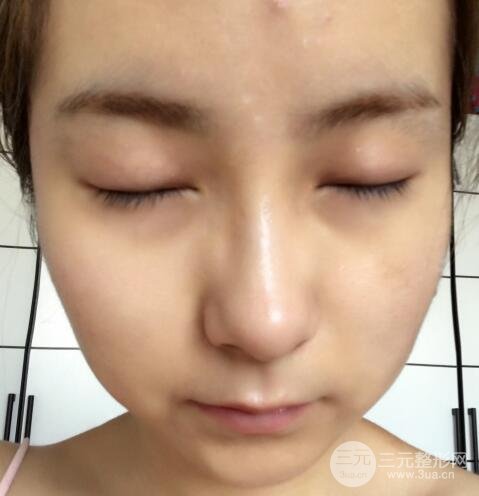 注射水光補(bǔ)水價(jià)格和案例圖片