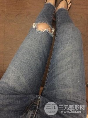 珠海萊茵門診部盧剛給我做的大腿抽脂手術(shù)，前后對比圖分享