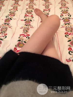 珠海萊茵門診部盧剛給我做的大腿抽脂手術(shù)，前后對比圖分享