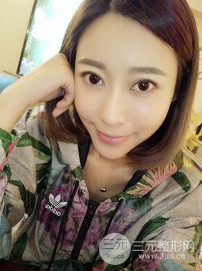 埋埋蛋白線.提升真實(shí)案例分享，珠海萊茵門診部馬中衛(wèi)醫(yī)生做的