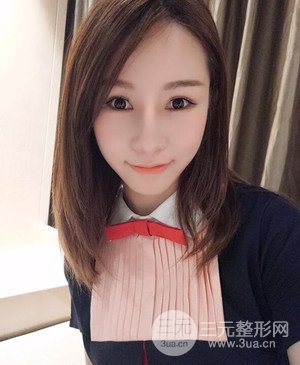 武漢美都張召醫(yī)生給我做的隆鼻整形手術(shù)，給大家分享一下前后照片