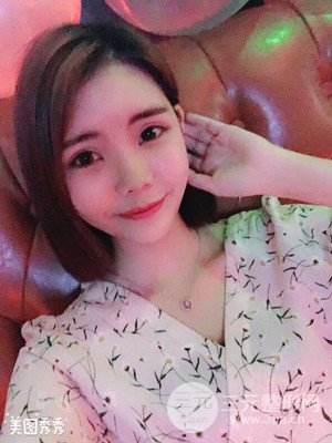 自體脂肪填充全臉真實案例——濟南愛容張慶國醫(yī)生做的