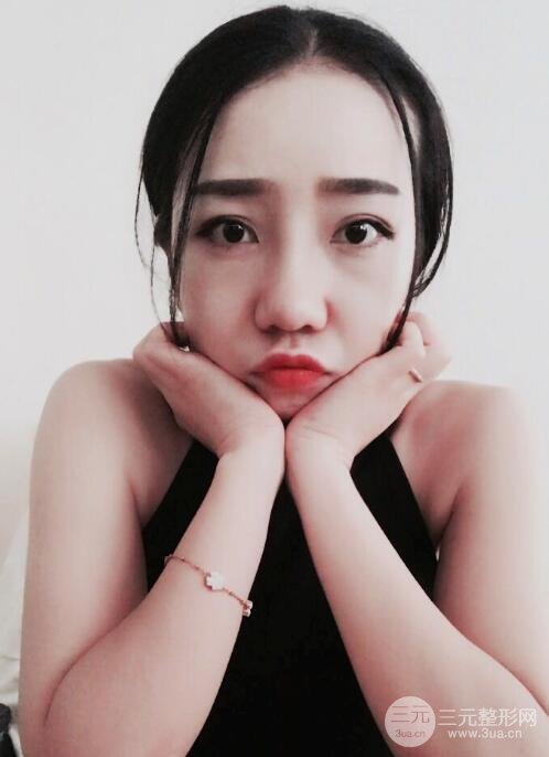 隆鼻整形價格和真人案例