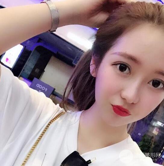 長得太著急是怎樣一種體驗？妹子血淚分享自體脂肪填充詳細部年輕化經(jīng)驗