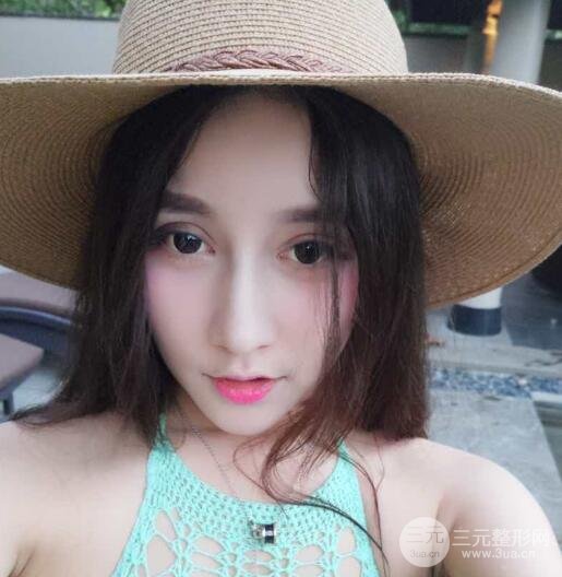 深圳源美做隆鼻失敗修復(fù)價(jià)格案例