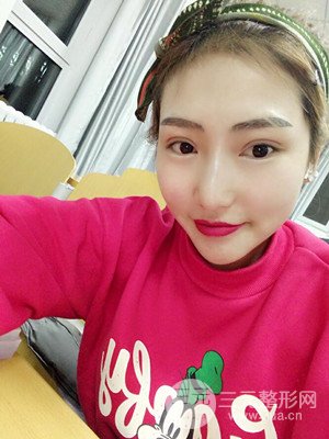 激光脫毛前后照片分享，真實(shí)案例~