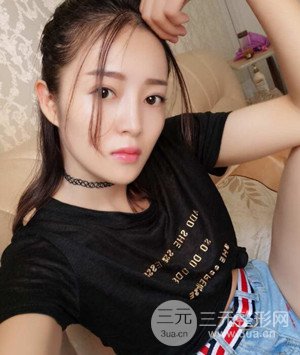 武漢葉子葉飛醫(yī)生給我做的切開雙眼皮手術(shù)，分享一下前后對比圖