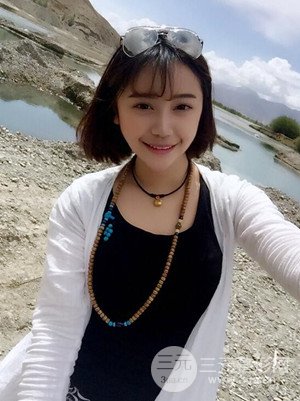 假體隆鼻+耳軟骨墊鼻尖真實案例，并附上前后對比圖~