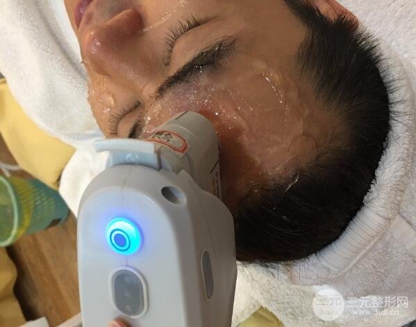 男士高強度聚焦超聲面b提升微整形真實案例