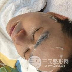 男士高強度聚焦超聲面b提升微整形真實案例