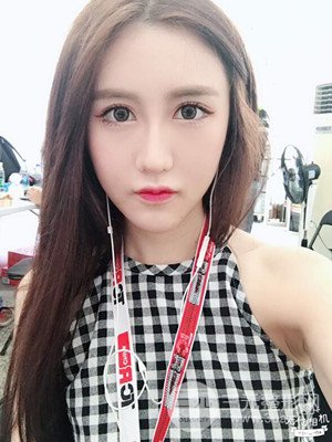 武漢一美汪國民醫(yī)生做的面部吸脂【案例】，分享一下前后對(duì)比圖片