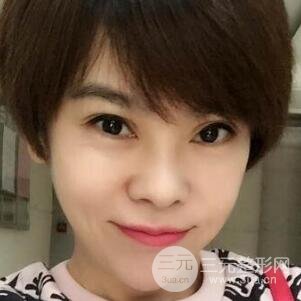 去做了埋線面b提拉術(shù)果很是不錯