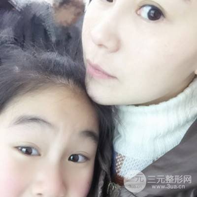 武漢美侖陳遠(yuǎn)海自體脂肪填充全臉案例，附上前后對比圖片